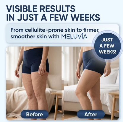 Meluvia™ SculptGlow – Firmer, More Toned Skin